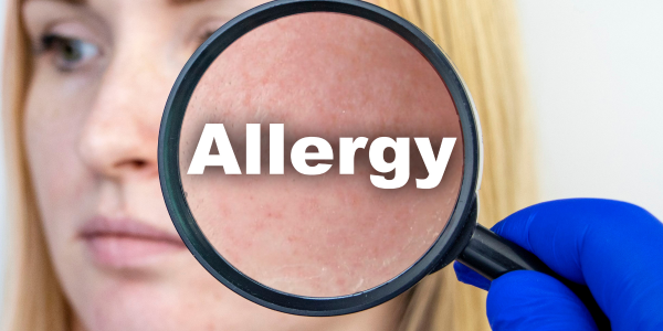 Alergia krzyżowa – szczegółowe omówienie